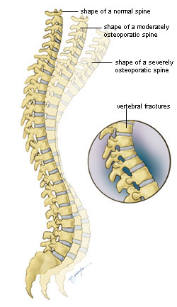 Backbone